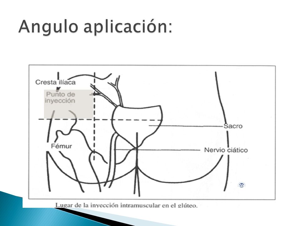 Inyeccion intramuscular en el gluteo